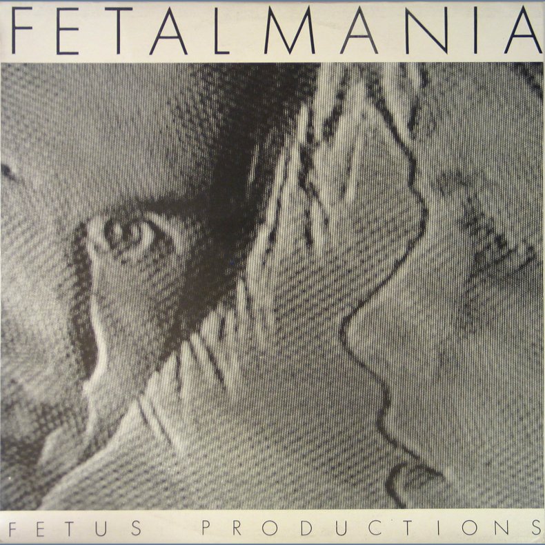 Fetal Mania