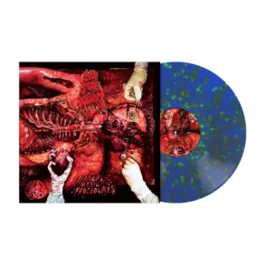 Manual Manic Procedures - 2024 European Metal Blade label Blue orange green splatter 9-track LP